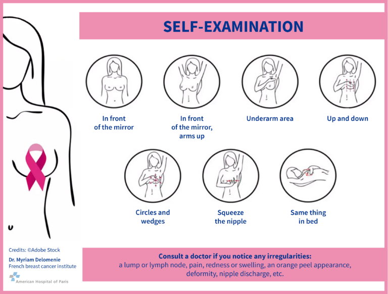 Infographie Auto-palpation